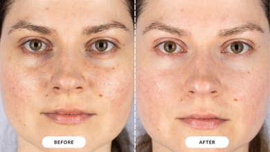 LED Face Mask Before and After: Experience Skin Transformation with the LED Face and Neck Mask