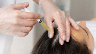 10 Reasons Why PRP Hair Treatment is More Effective Than Traditional Solutions