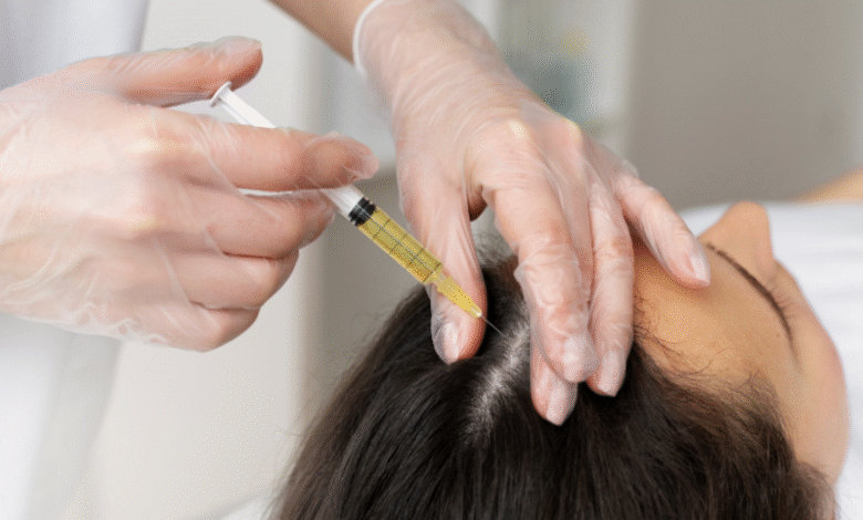 10 Reasons Why PRP Hair Treatment is More Effective Than Traditional Solutions