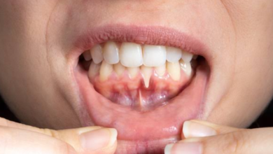Why Receding Gums Can Change The Way Teeth Respond To Temperature