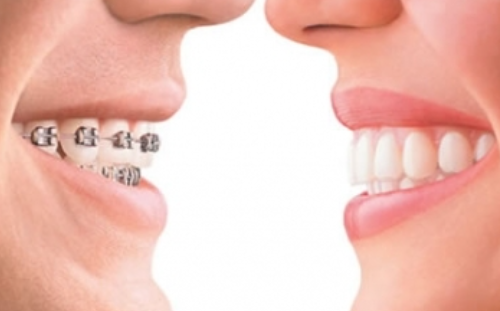 The Connection Between Orthodontics And Jaw Alignment